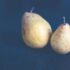 The Health Benefits of Muscadine Grapes
